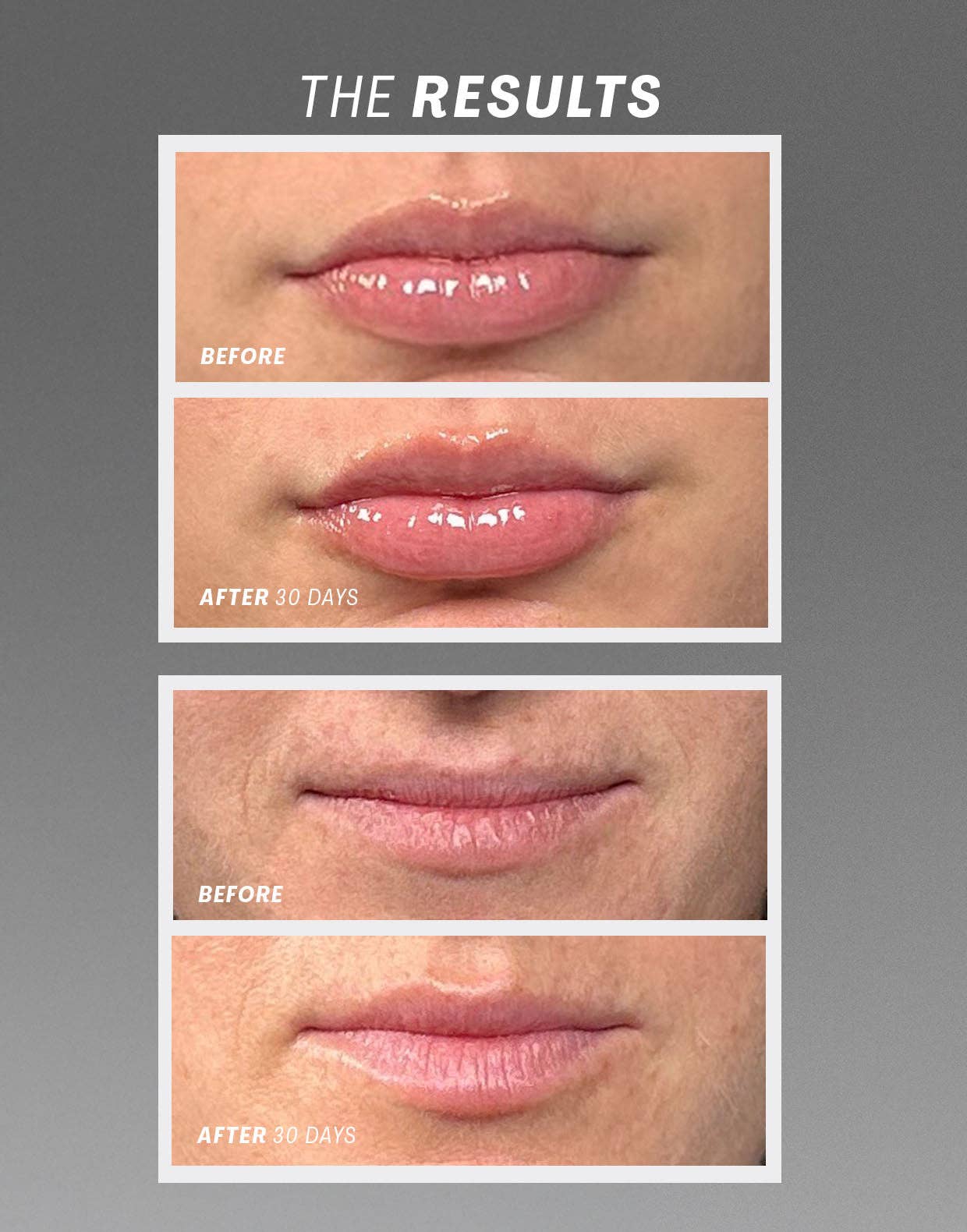 Lip Oasisᵀᴹ Glossy Treatment - Detour Boutiques